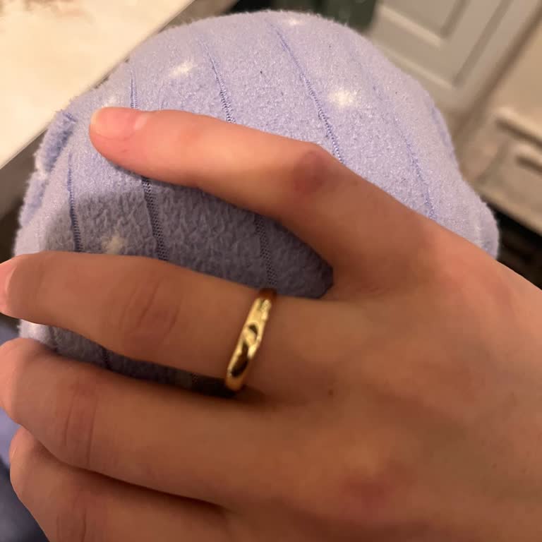 Yüzüklerde Çizik Sorunu Ve Gerçek Değişim Talebi