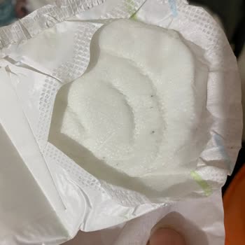 Pedlerde Siyah Lekeler Hijyen Endişesi Yaratıyor