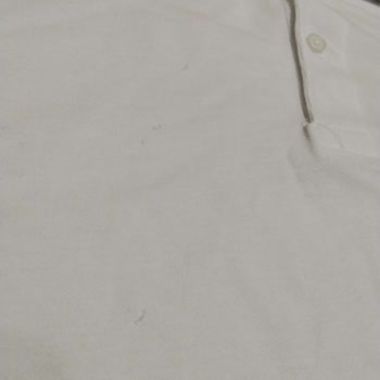 Defolu T-Shirt İadesi Ve Kredi Kartı Geri Ödemesi