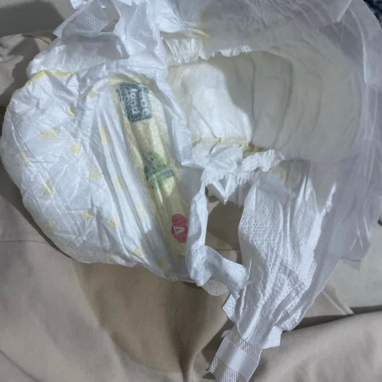 İlk Kullanımda Sızdıran Bebek Bezi Ve Ücret İadesi Talebi