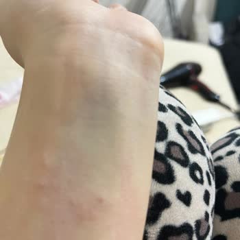 Yanıltıcı Çelik Bilgisiyle Satılan Bileklik Karardı Ve Cildimi Tahriş Etti