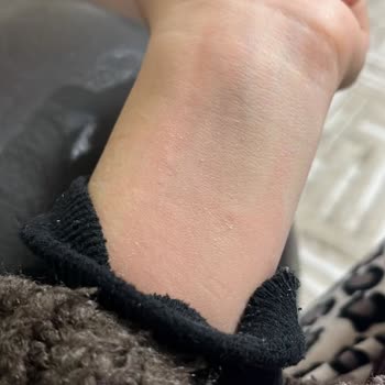 Yanıltıcı Çelik Bilgisiyle Satılan Bileklik Karardı Ve Cildimi Tahriş Etti