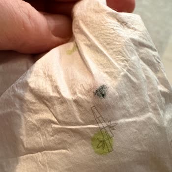 Sleepy Bebek Bezinde Yabancı Siyah Madde Ve Hijyen Sorunu