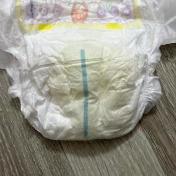 Yemeksepeti Üzerinden Aldığım Tarihi Geçmiş Bebek Bezi, Şiddetli Pişik Ve Sızdırma