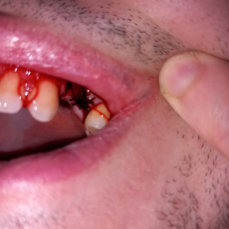 Alpi Diş Kaynarca’da Çocuğuma Yapılan Hatalı İşlem Ve Ücret İadesi