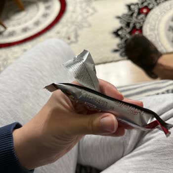 Tadelle Şekersiz Çikolatada Görsel Bozukluk Ve Sağlık Endişesi