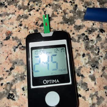 Dexcom G7 Sensöründe Ölçüm Farkı Ve İade Talebi