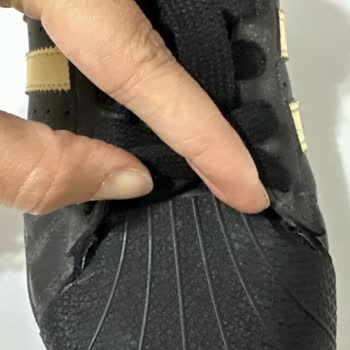 Adidas Superstar Ayakkabısında Kalite Sorunu Ve İade Reddi