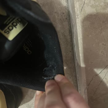 Adidas Superstar Ayakkabısında Kalite Sorunu Ve İade Reddi