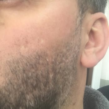 Suit Güzellik Merkezleri Samsun Şikayeti