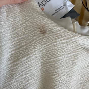 Trendyol’da Sipariş Edilen Koton Elbisesinde Dikiş Bozukluğu Ve Leke Sorunları