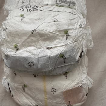 Defolu Bebek Bezlerinde Sert Ve Şeritli Parçalar