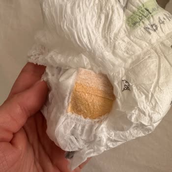 Defolu Bebek Bezlerinde Sert Ve Şeritli Parçalar