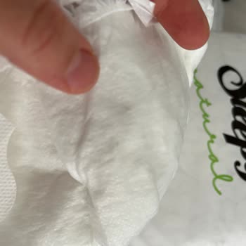 Bebek Bezinde Yabancı Cisim Bulunması