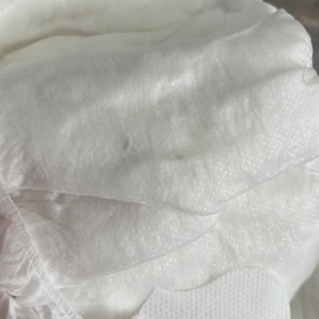 Bebek Bezinde Yabancı Cisim Bulunması