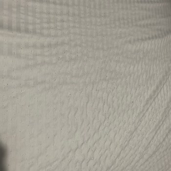 Aşırı Tüylenme Ve Renk Atlama Nedeniyle Ücret İadesi Talebi