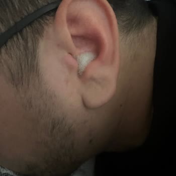 Abfen Farma Oksibor Kulak Damlası Sonrası Sürekli Çınlama ve İşitme Sorunu