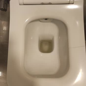 Kaliteli Klozet Kapağı Aniden Kırıldı Ve Ücretsiz Değişim Talebi