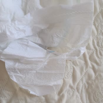 Molfix Bebek Bezlerinde Tekrarlayan Kusurlu Alt Kısım