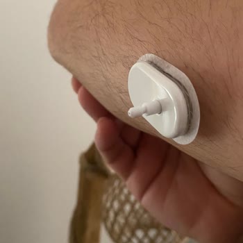 Sensör İğnesi Vücudumda Sıkıştı, Üretici Kullanıcı Hatası Diyerek Sorumluluk Kabul Etmedi