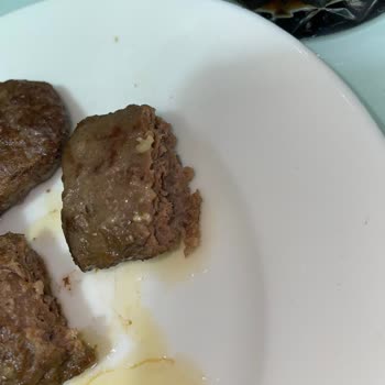 Migros Sancaktepe Yenidoğan Şubesinde Köfte İçinde Kıl Bulunması Hijyen Endişesi