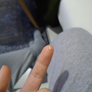 Beyoğlu Çikolatasında Antep Fıstığı Kabuğu Tespiti Sağlık Ve Hijyen Sorunu