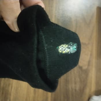 Suwen Çoraplarının Sert Nakışı Ayak Ağrısına Neden Oluyor