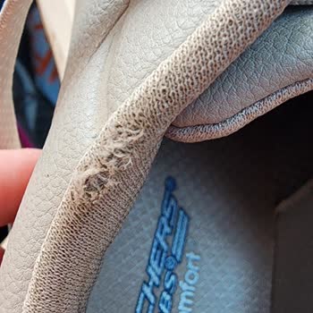 Skechers Ayakkabısının Astarı Dört Ayda Deforme Oldu, Kalite Şüphesi