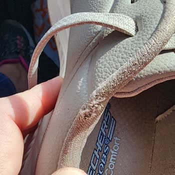Skechers Ayakkabısının Astarı Dört Ayda Deforme Oldu, Kalite Şüphesi