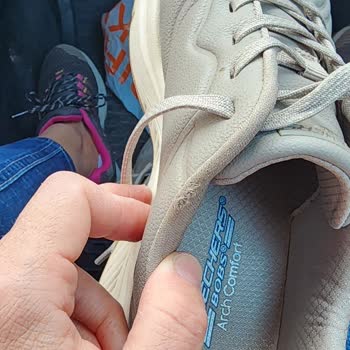 Skechers Ayakkabısının Astarı Dört Ayda Deforme Oldu, Kalite Şüphesi