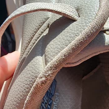 Skechers Ayakkabısının Astarı Dört Ayda Deforme Oldu, Kalite Şüphesi