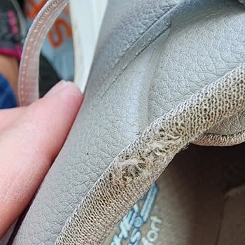 Skechers Ayakkabısının Astarı Dört Ayda Deforme Oldu, Kalite Şüphesi