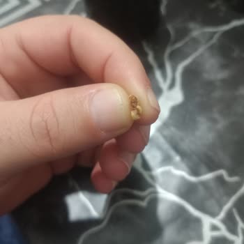 Ülker Haylayf Sandviç Bisküvi'nde Bulunan Bilinmeyen Kahverengi Parça İçin Açıklama Ve Özür Talebi