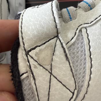 Kısa Sürede Deforme Olan Skechers Ayakkabılar İçin İade Talebi