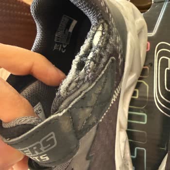 Kısa Sürede Deforme Olan Skechers Ayakkabılar İçin İade Talebi