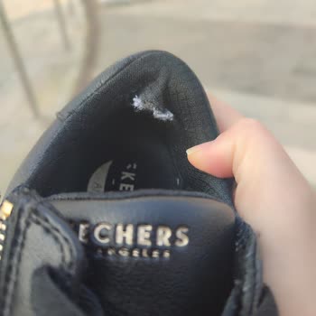 Kısa Sürede Deforme Olan Skechers Ayakkabıda Açıklama Eksikliği Ve Değişim İade Talebi