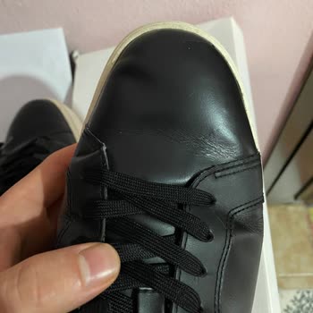 Boyner Calvin Klein Ayakkabısında Çatlak Ve Kabarma Kullanıcı Hatası Olarak Değerlendirildi