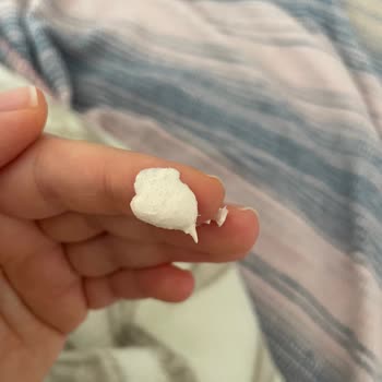 Avene Very High Protection Güneş Kremi Bozuk Çıktı, Yanma Ve Sağlık Endişesi