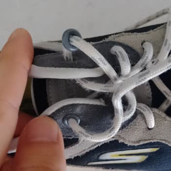 Garanti Kapsamındaki Skechers Ayakkabım Kısa Sürede Yırtıldı, Değişim Talebim Reddedildi