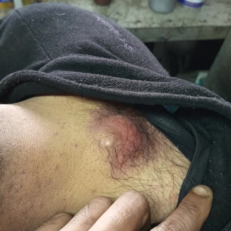 Silivri Devlet Hastanesinde Yanıltıcı Yönlendirme Ve İlgisiz Personel