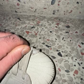 Garanti Kapsamındaki Adidas Superstar Ayakkabım Açıldı, Değişim Ve İade Talep Ediyorum