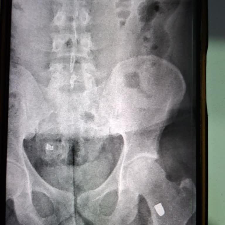 Bolu Gerede L Tipi Cik Şikayeti