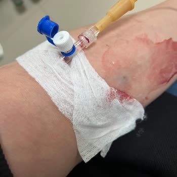 Kara Mustafa Paşa Devlet Hastanesi Acil Personelinin İlgisiz ve Saygısız Olması