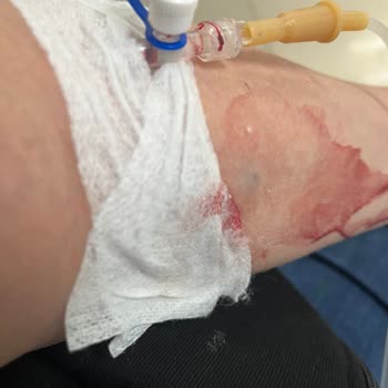 Kara Mustafa Paşa Devlet Hastanesi Acil Personelinin İlgisiz ve Saygısız Olması