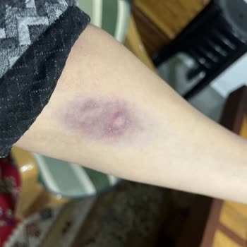 Kara Mustafa Paşa Devlet Hastanesi Acil Personelinin İlgisiz ve Saygısız Olması