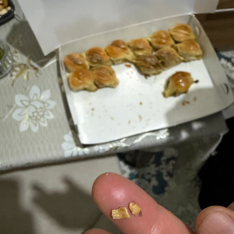 Fıstıklı Midye Baklavada Sert Kabuk Parçaları Ve Diş Kırılma Riski