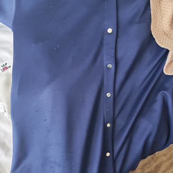 Oysho Takımında Hızlı Tüylenme Ve Görmezden Gelinen Şikayet