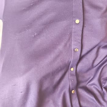 Oysho Takımında Hızlı Tüylenme Ve Görmezden Gelinen Şikayet