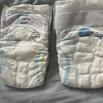 Molfix 5 Numaralı Bebek Bezinde Şiddetli Taşırma Ve Sızıntı Problemi