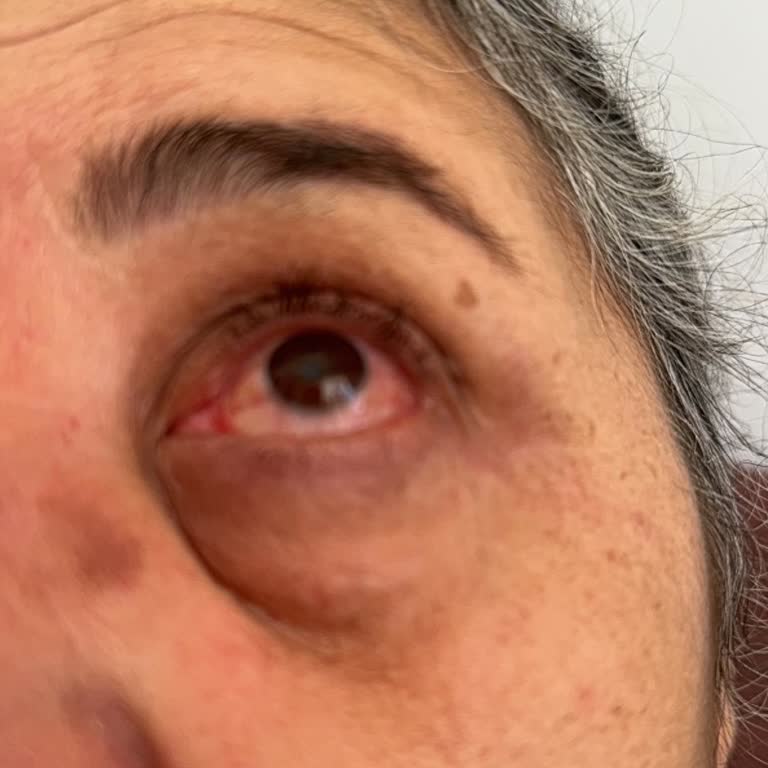 Naldöken Çam Ağaçları Poleni Ve Tırtılları Nedeniyle Alerji Sorunu İçin Acil İlaçlama Talebi